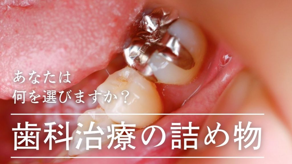 歯科治療の詰め物の選び方｜高松市の吉本歯科医院